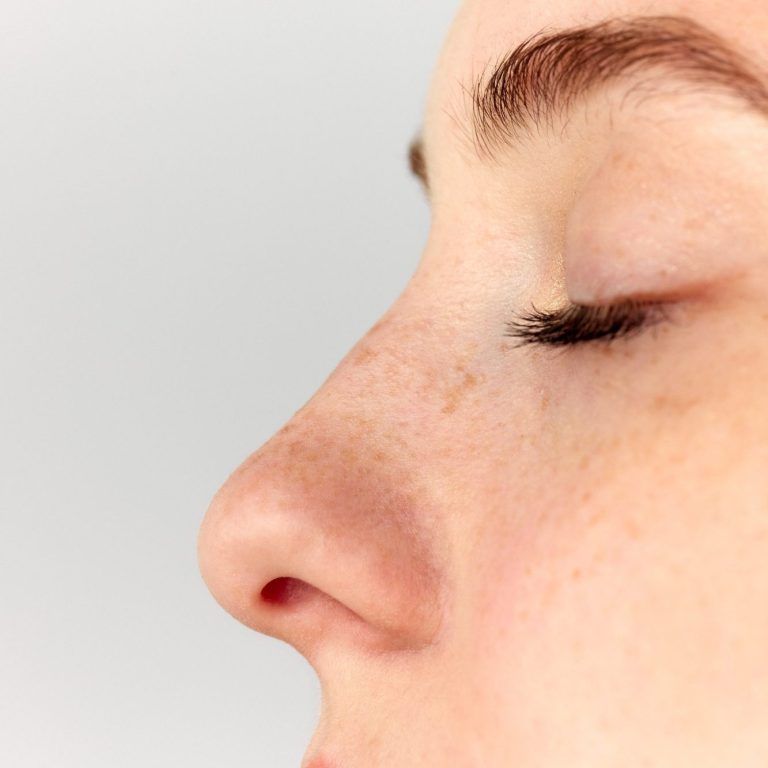 Hyaluron-Unterspritzung. Praxis für Ästhetik und Anti-Aging, Hamburg-Eppendorf. Porträt einer Frau mit geschlossenen Augen, Gesichtspflege und dekorativer Linienführung.
