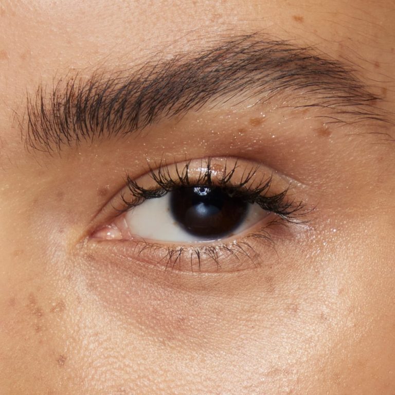 Lippenunterspritzung. Praxis für Ästhetik und Anti-Aging, Hamburg-Eppendorf Porträt einer Frau mit frischer Haut und blauen Augen, die leicht nach oben blickt.