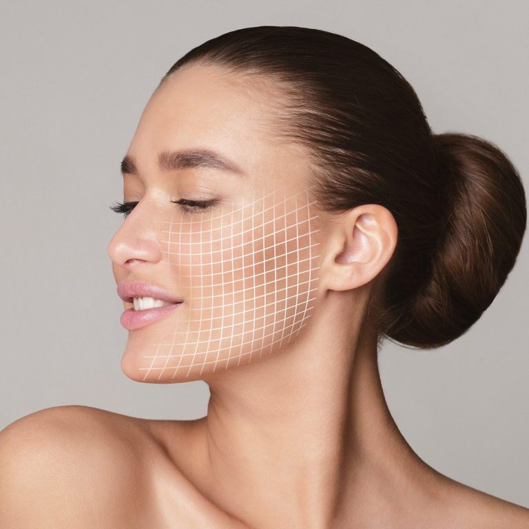 Aptos Fadenlifting zur Gesichtsstraffung. Praxis für Ästhetik und Anti-Aging, Hamburg-Eppendorf. Profilansicht einer Frau mit sanften Gesichtszügen und einem grafischen Linienmuster.