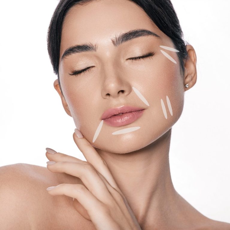 Hyaluron-Unterspritzung. Praxis für Ästhetik und Anti-Aging, Hamburg-Eppendorf. Porträt einer Frau mit geschlossenen Augen, Gesichtspflege und dekorativer Linienführung.